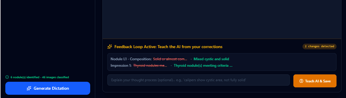 VoxelVision Feedback Loop Active panel showing 2 detected corrections: Nodule L1 composition reclassification and Impression update, with Teach AI & Save button
